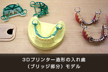 3Dプリンター造形の入れ歯（ブリッジ部分）モデル）